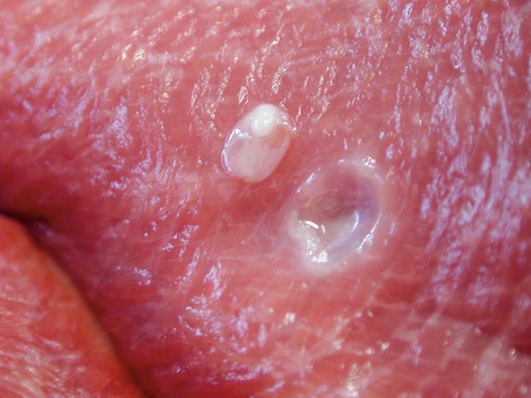 Infected animal with cysticercosis