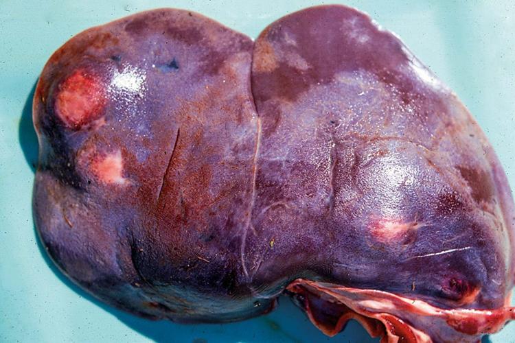 Liver flukes
