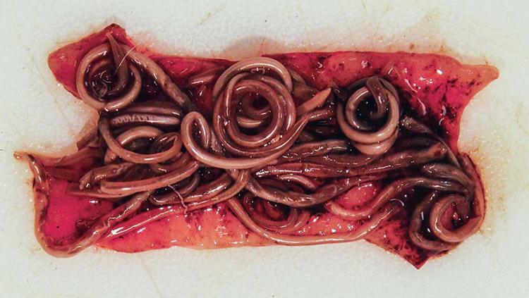 Closeup of intestine full of ringworms